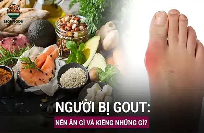 Bệnh gout nên ăn gì? Top thực phẩm tốt cho người mắc gout