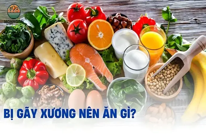 Gãy xương nên ăn gì? Thực đơn dinh dưỡng giúp xương khỏe mạnh