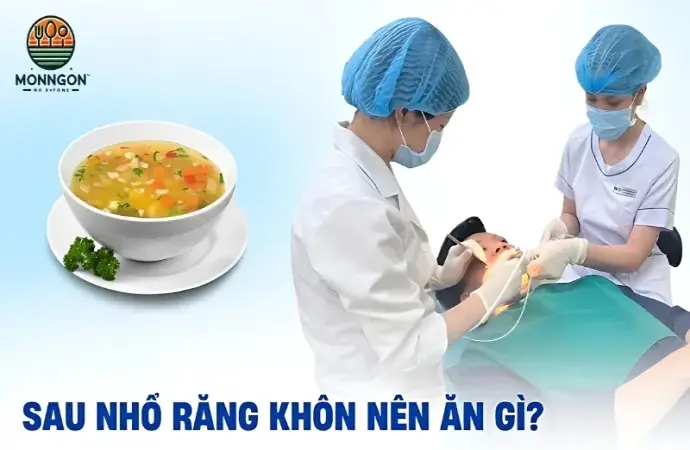 Mới nhổ răng khôn nên ăn gì? Top thực phẩm giúp hồi phục nhanh chóng